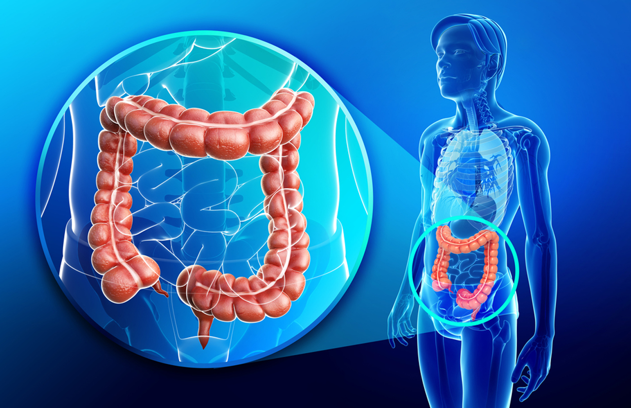 myths colon cancer