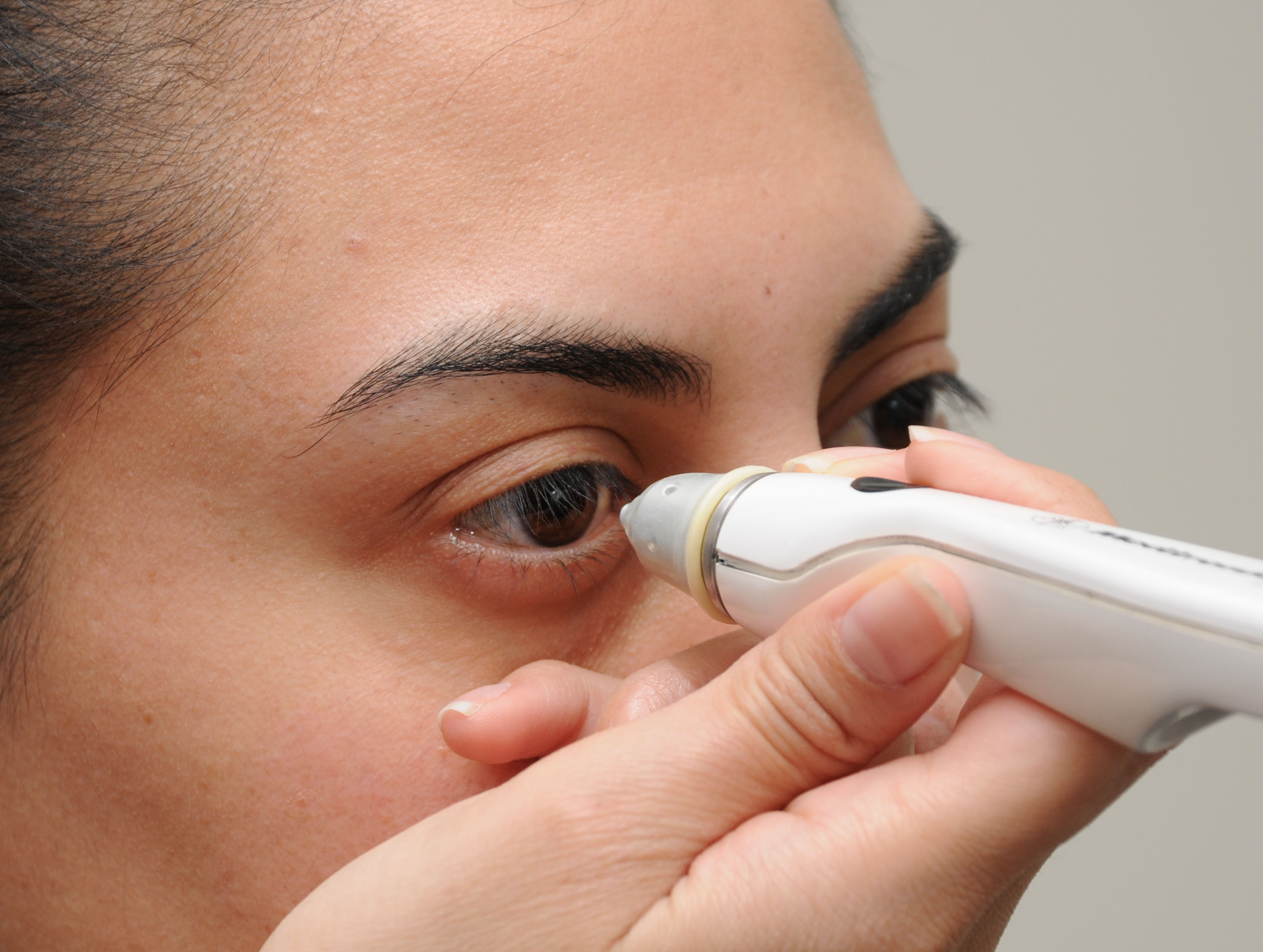 Glaucoma