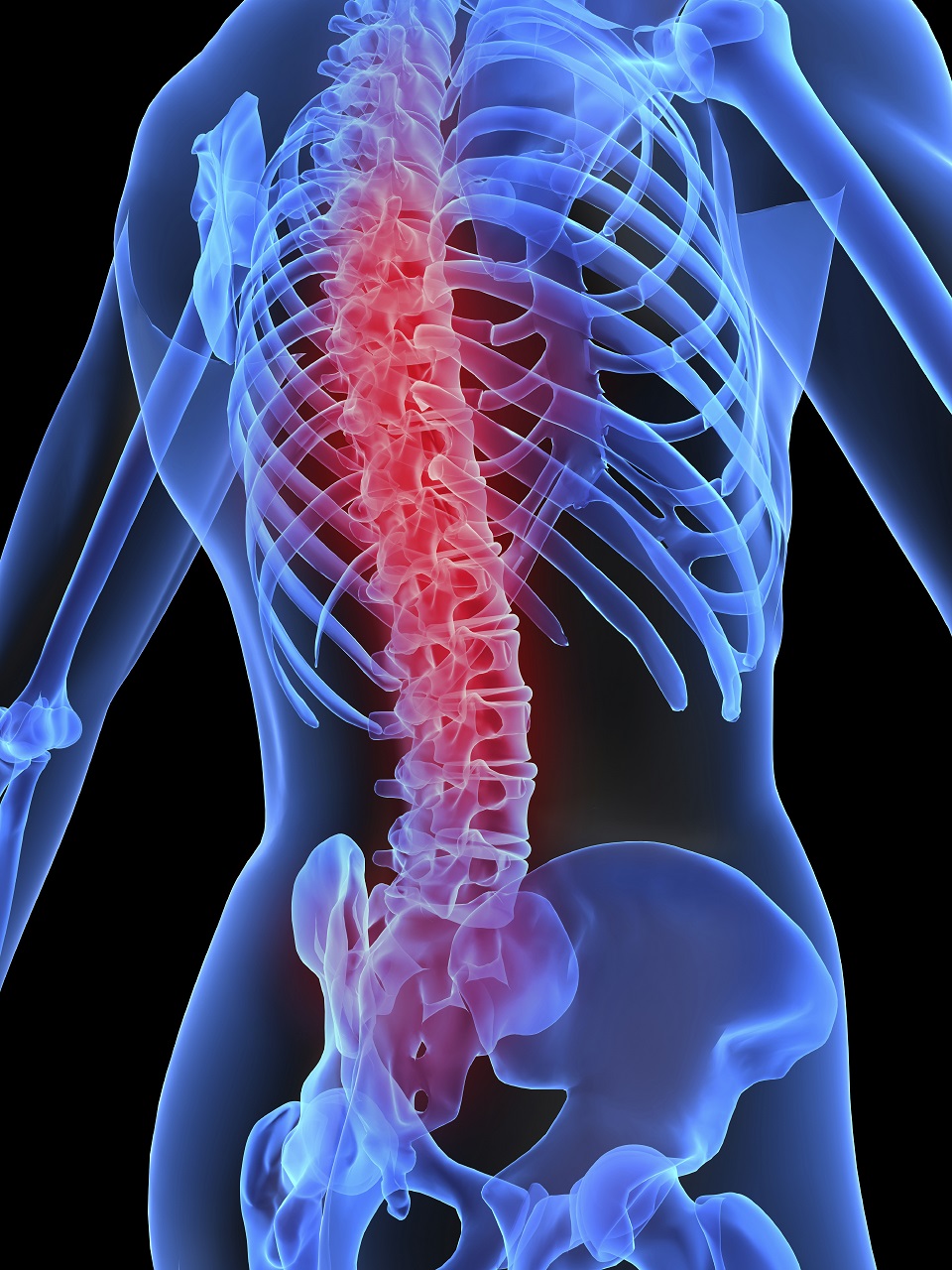 spine tumour