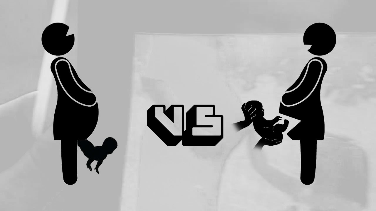 c-section vs vaginal birth