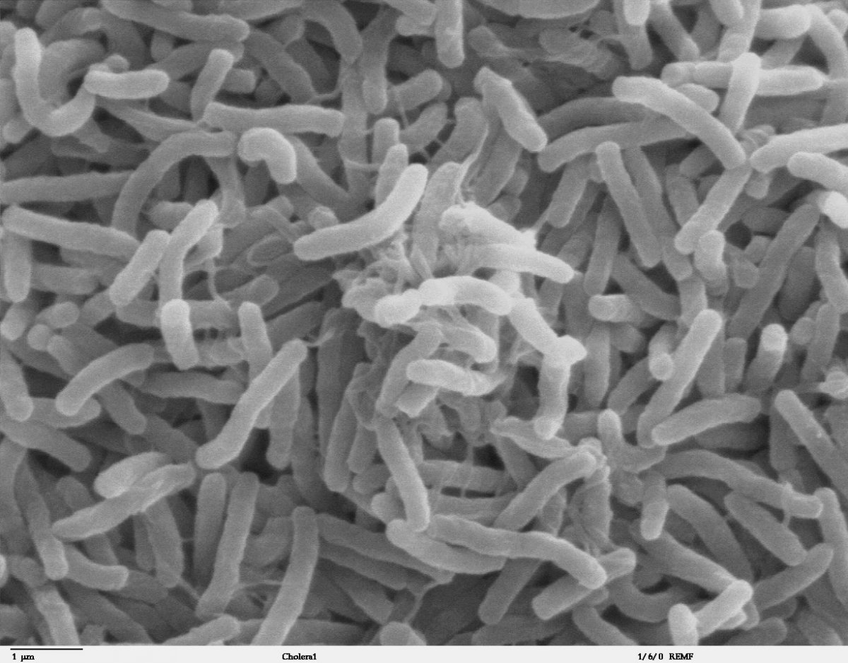 what is cholera
