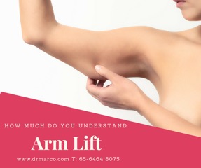 arm lift