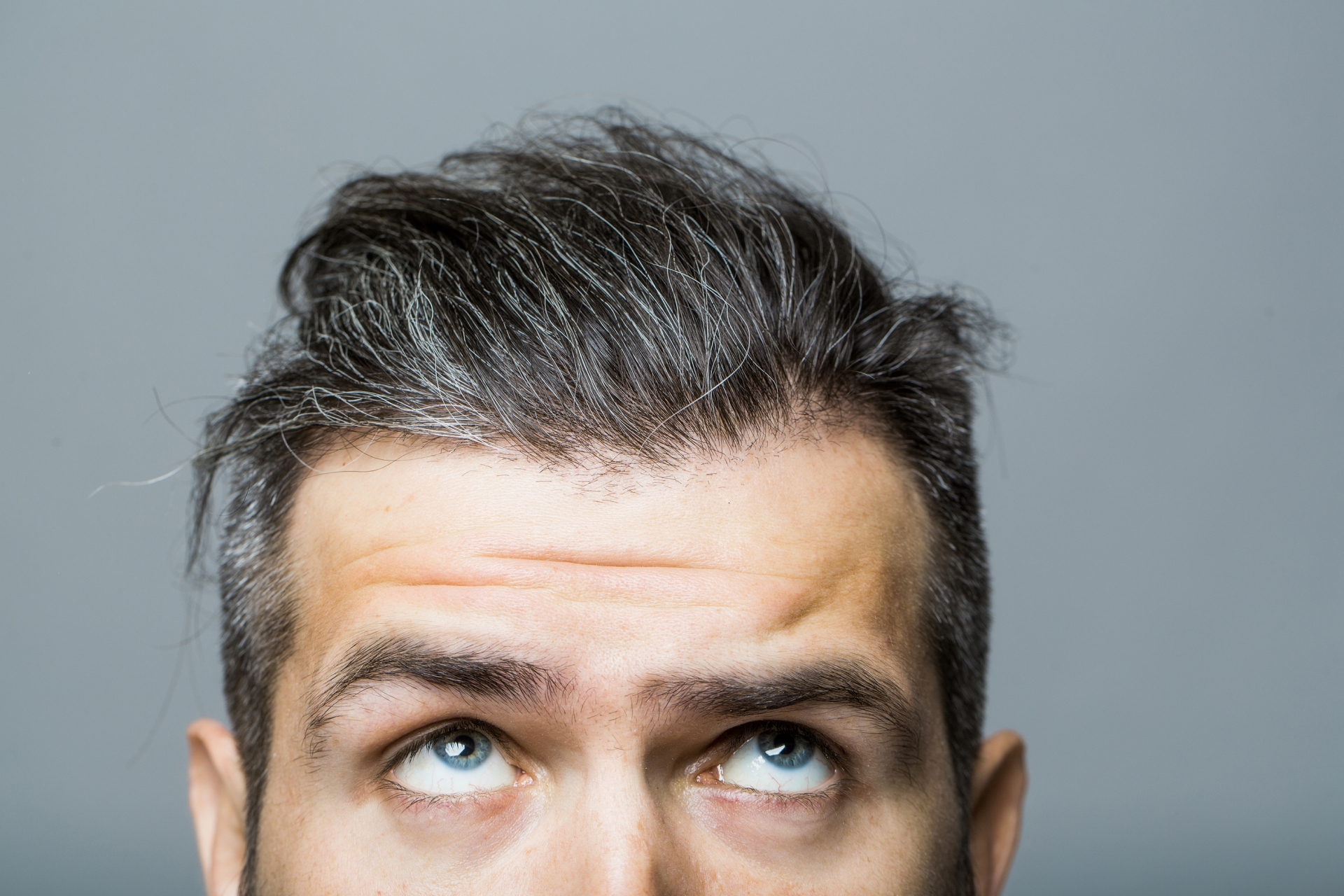 hair loss