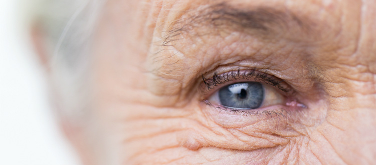 aging eyes