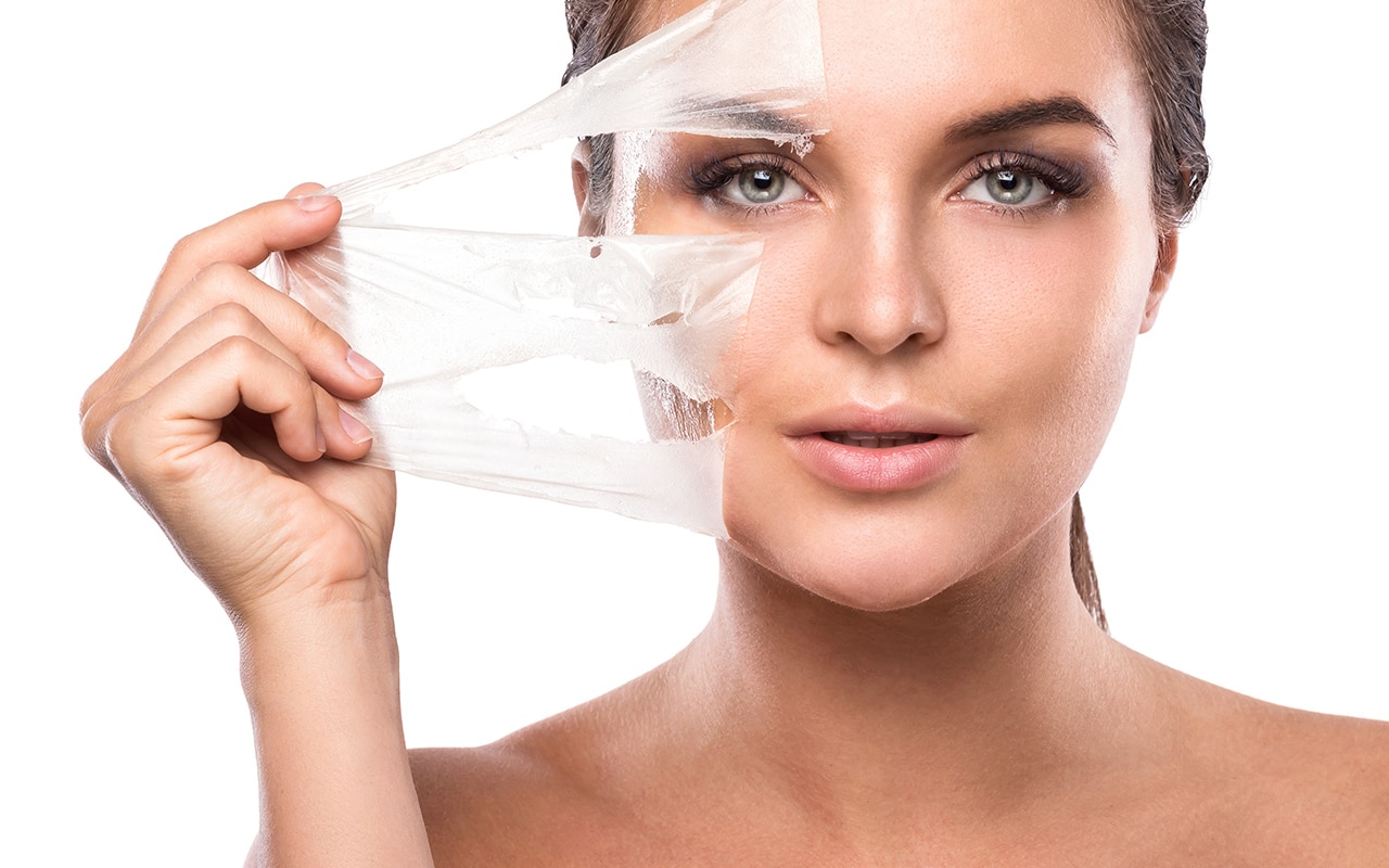 chemical peel