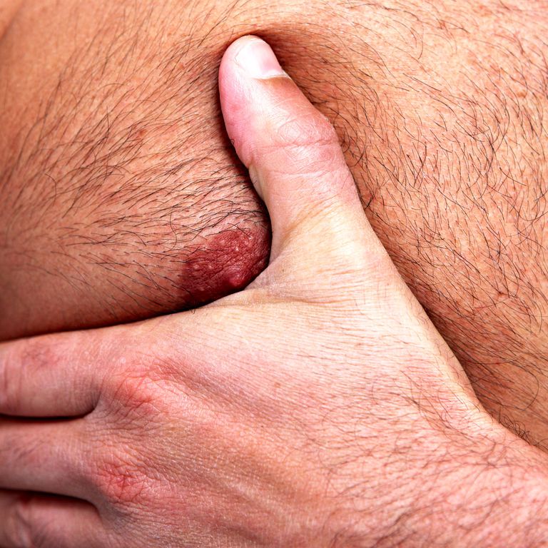 nipples hurt