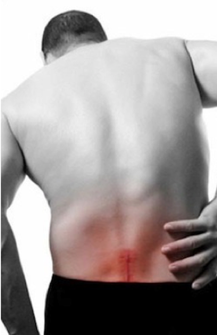 Slipped Disc Severe Back Pain