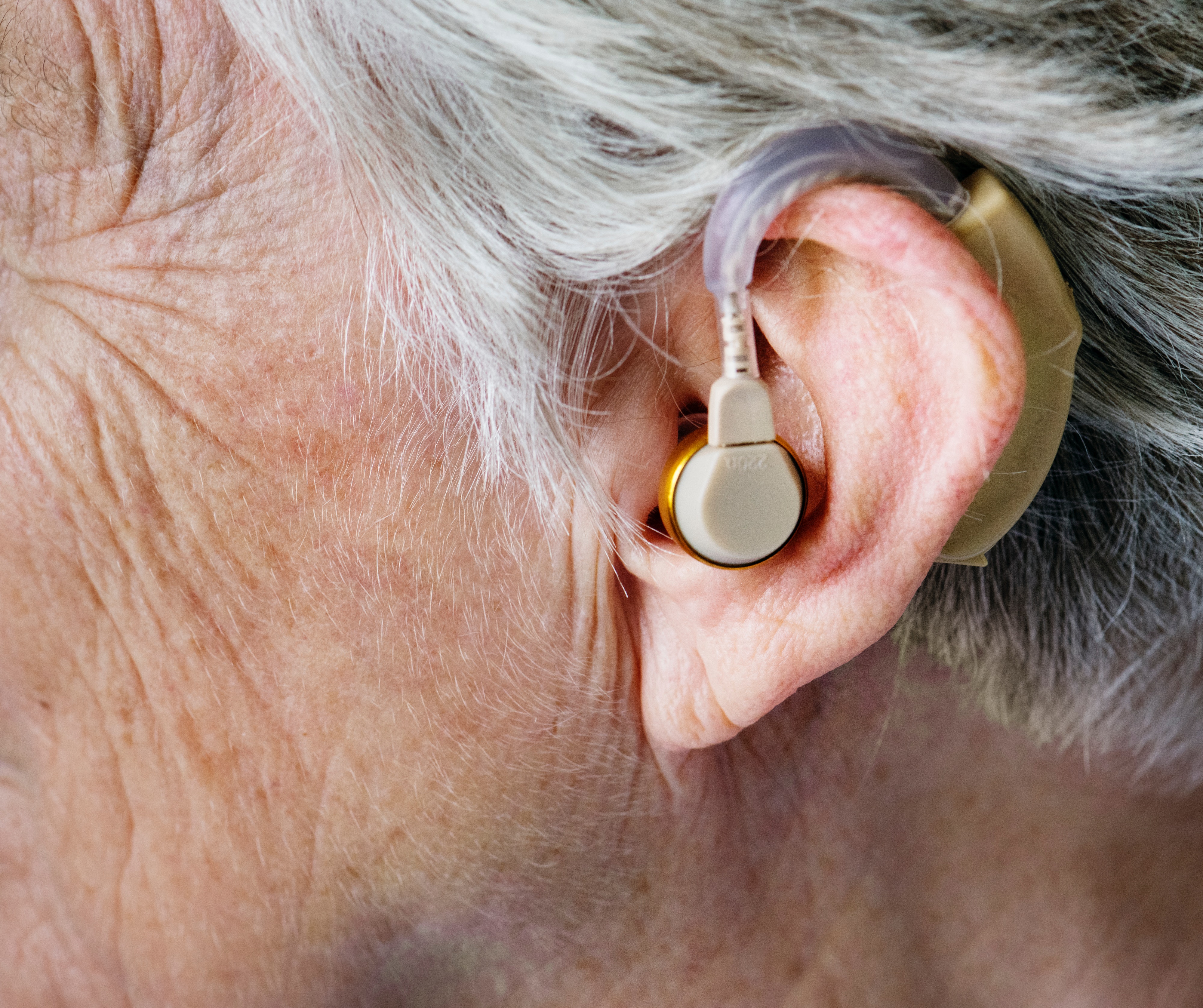 Early Diagnosis and Treating Hearing Loss Helps Prevent Dementia