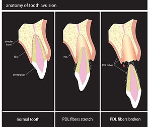First Aid Tips to save a knocked-out tooth
