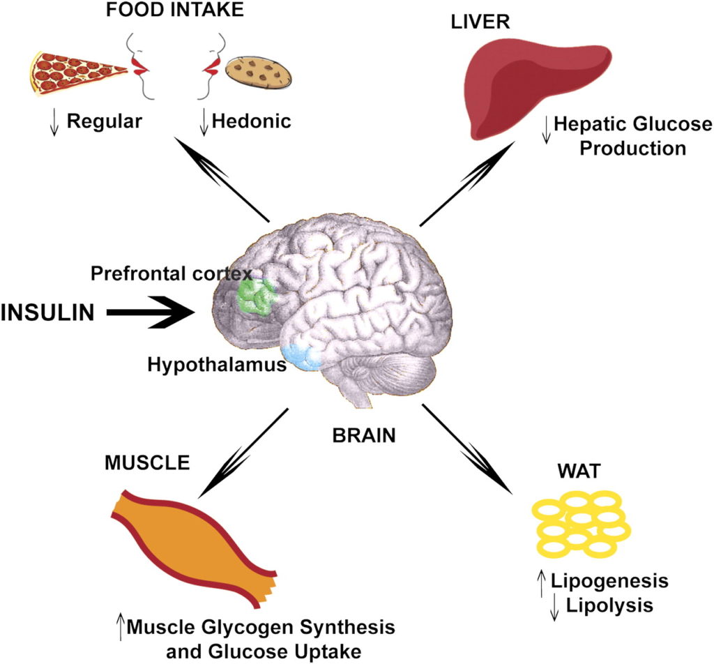 diabetes insulin memory brain