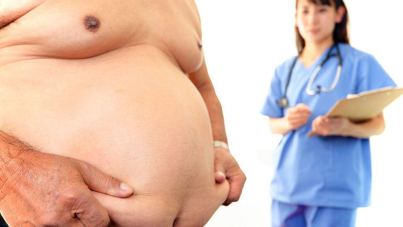 obesity and COVID-19 coronavirus severe COVID-19 overweight