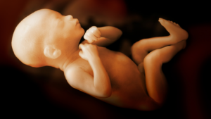 Breech Baby