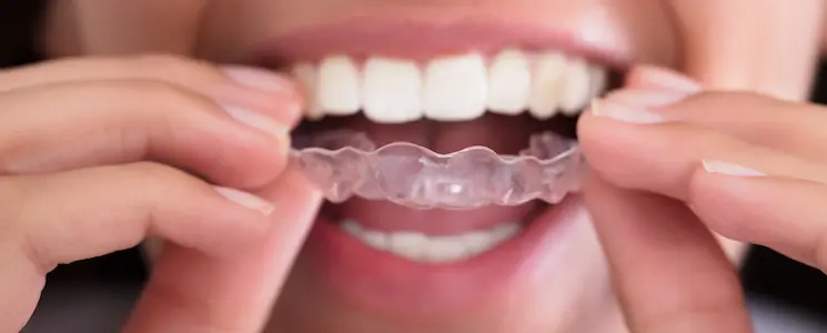 Bruxism
